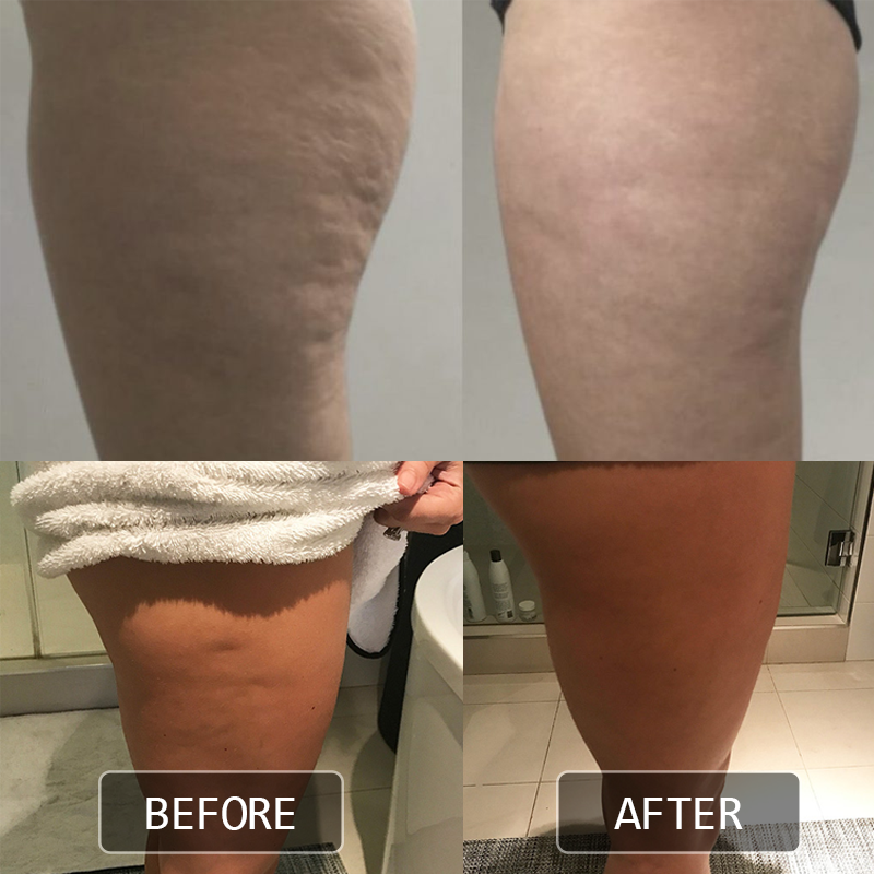 Cleanova Cryo Thermo Firming Gold Gel